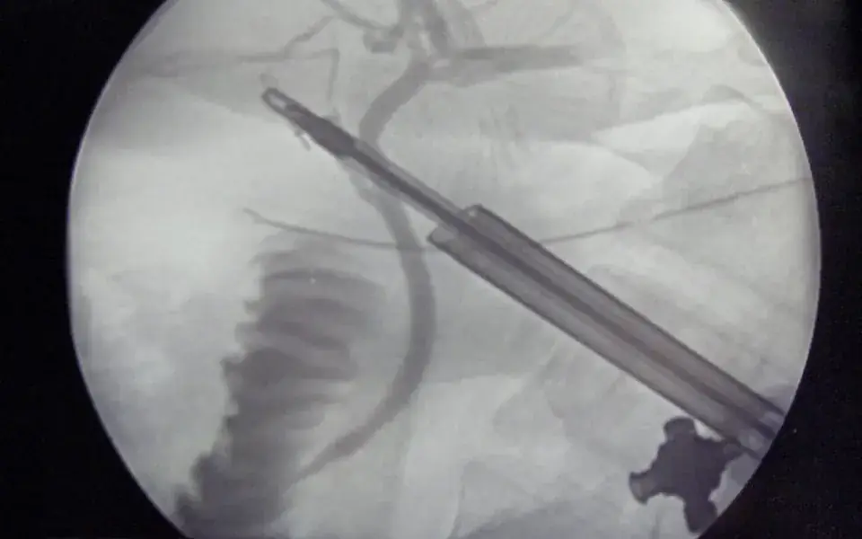 Illustration: X-ray